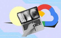 Google Is Introducing New AI Health Models And Physicians Are Utilising Them - Here Is How