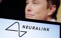 Elon Musk Informs Neuralink's First Human Patient Was Able To Manipulate A Mouse With Thoughts